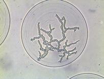 sort germinated fungal spores like Trichoderma reseei spores.
