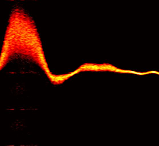 Autocorrelation spectrogram, sequence:...3.4.5.6.7.8.9 Autocorrelation spectrogram, sequence:...3.4.5.6.7.8.9 Fig.