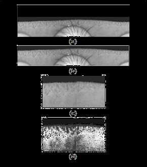 matching different iris patterns at a later stage. The problem of that the iris can be rotated in the image is not resolved by this transformation.