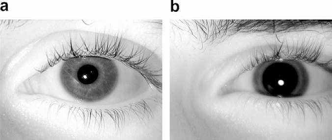 In effect, the eye image acquired at different times can exhibit a large variation in