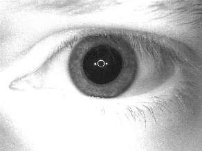 The iris radius does not change for all the eyes even when the pupil is undergoing dilation and constriction.