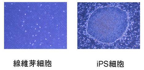 Pluripotent Stem (ips) cells.