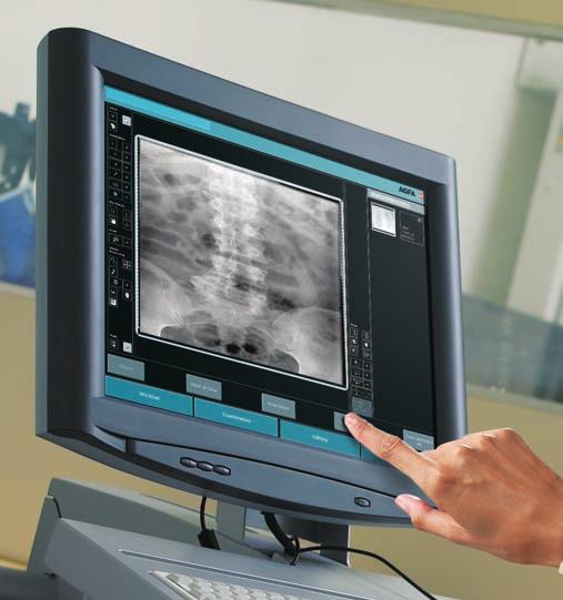 The DiRex-SP System offers any imaging institution a very cost effective way to benefit from digital imaging. The system offers superior quality study results at a very low exposure dose.