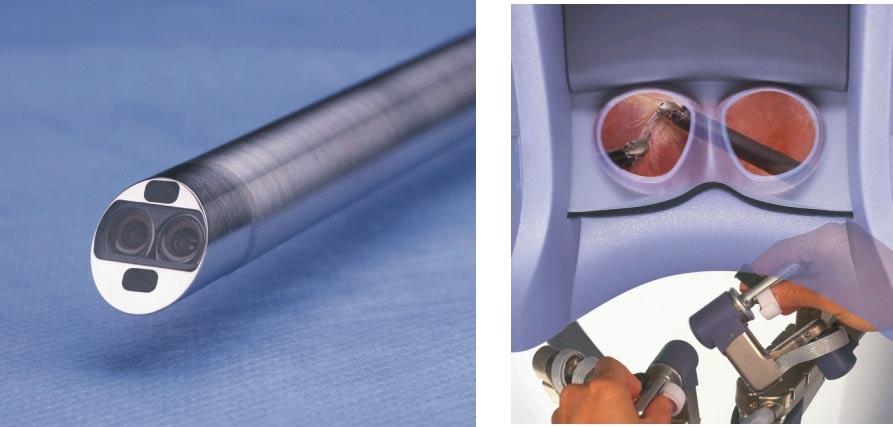 InSite Vision System with high resolution 3-D Endoscope The InSite Vision System provides the surgeon with a 3-D view of the operating field (Figure 5).