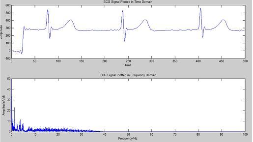 failure detection of the QRS complex. It is essential to remove the unwanted noise before the ECG signals can be applied for future use like analysis.