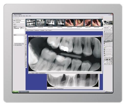 position Four (4) imaging plate sizes Compatible with AC and DC intraoral x-ray units New DIGORA for Windows 2.