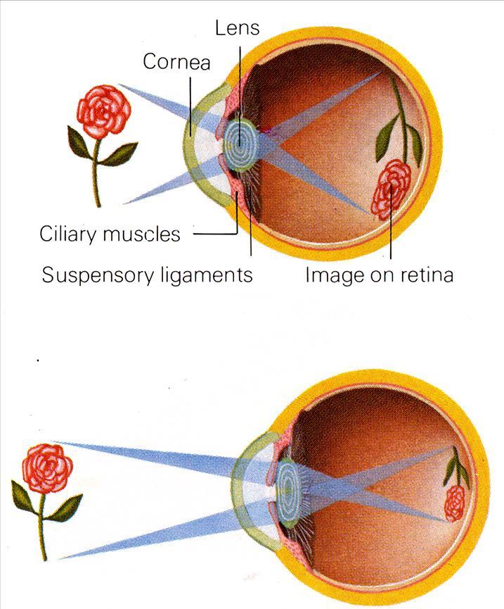 The Eye The ability to focus changes over time. From 16 years of age some cells of the of the lens die, making it less flexible. The resulting condition is presbyopia, meaning old sightness.