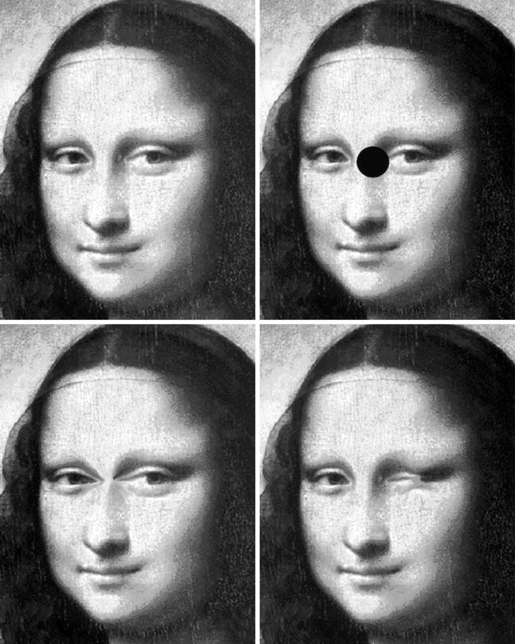 A C D Figure 2. Photographs of a Mona Lisa portrait modified by computer software. A, Normal portrait., Scotoma in a part of the face.