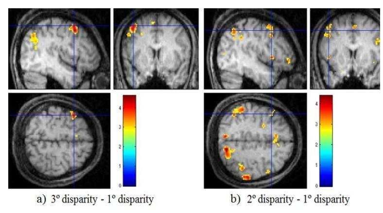 EEG signal In [Kim2011] the power of the EEG signals in beta frequency was significantly higher when watching 3D contents compared to 2D contents fmri Eye blinking