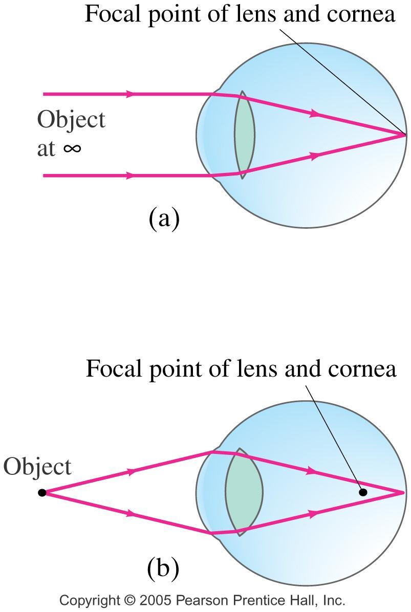 25.2 The Human Eye; Corrective Lenses Most of the refraction is done at the
