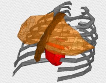 7 shows the model of human chest structure. The pulmonary artery locates in front of heart. In front of pulmonary artery, there are also sternum, ribs and chest muscle around.