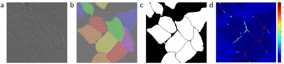 U-Net Specifics Designed for biomedical image processing: cell segmentation Data augmentation via applying elastic deformations, which is natural since deformation is a common variation of tissue