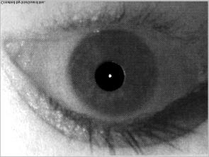 Fig. 1. Image of living eye (left) and the corresponding printout (right) of FAKE1 variant (i.e. prepared with HP LaserJet 1320 printer on a typical matt paper). Fig. 2. Same as in Fig.