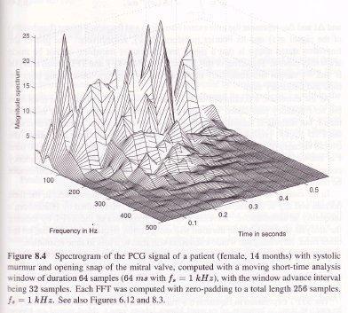 STFT example: phonocardiogram An alternative representation of the spectrogram: interpolated