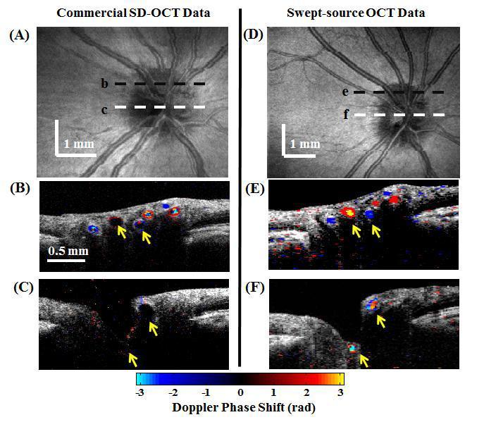 over SDOCT MIT Retinal Blood Flow with 200kHz Doppler OCT 1. Biomedical Optics Express Vol 2, Issue 6, May 2011 2.