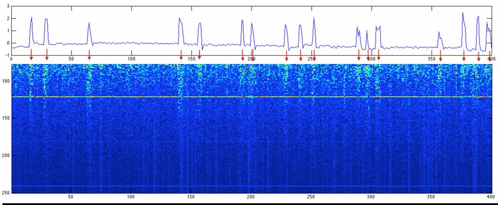 m) Plotting ECoG frequency data versus finger flexion data it can be observed that there is clearly increase in activity for all frequencies (75 200 Hz)