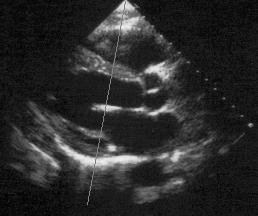 image to guide the M-mode ultrasound beam.