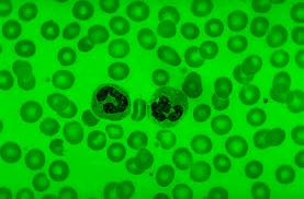 Detection and Counting of Blood Cells in Blood Smear Image Calculation Of Area Number of pixels in one cell makes its area.