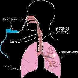 BRONCHOSCOPE: Are used for examining the air passages into lungs. Some endoscopes are rigid tubes with a light source to illuminate the area of interest.