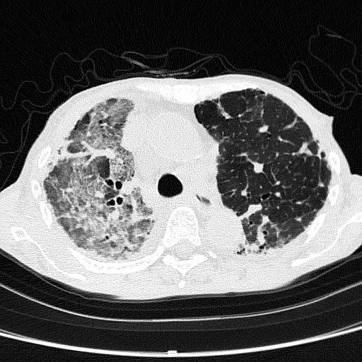 14 Examples of CT images (Left: Hybrid Gamma PXL,