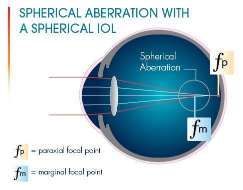 AcrySof IQ Toric IOL Spherical Aberration The Problem: Occurs when light rays are