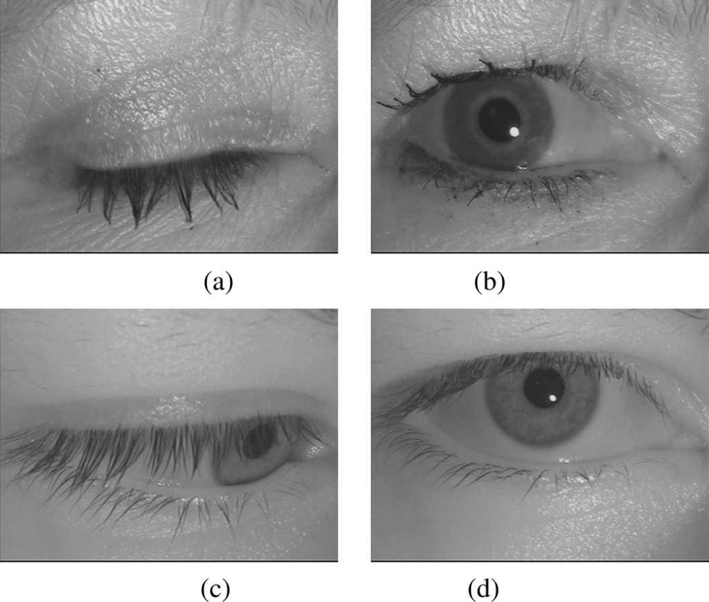 HOLLINGSWORTH et al.: IRIS RECOGNITION USING SIGNAL-LEVEL FUSION OF FRAMES FROM VIDEO 839 Fig. 3. Our automated experiments contain a few incorrect segmentations like the one shown in (a).