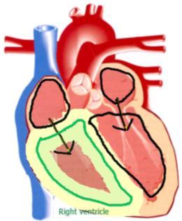Figure 1A: An example of a quantitative ink constraint in a heart anatomy exercise. The sketch on the left has the chambers labeled along with blood flow arrows.