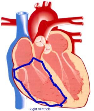 Figure 1B: Two drawings for the right ventricle that violate the quantitative ink constraint.