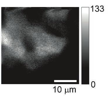 (Right) Direct wavefront sensing using confocal fluorescence images of stained neurons under a 100-µm-thick fixed mouse brain slice. From M. Rueckel et al. Proc. Natl. Acad. Sci.