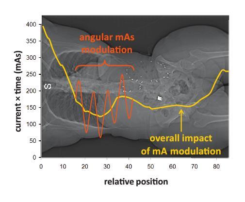 Z-axis dose modulation Bushberg JT, et al.