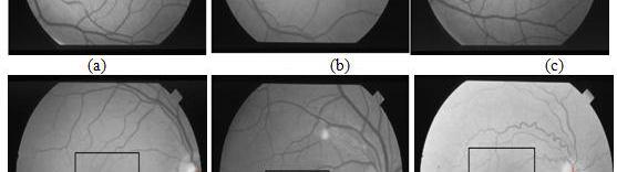 13 location of OD center and macula center in retinal image is marked in red colour.