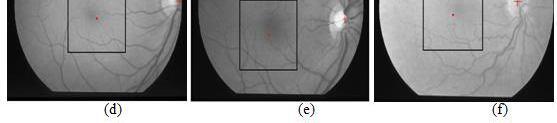 13 Sample macula centered images in the STARE database The validation of the result is obtained by the application