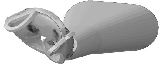 Figure 5. Strain of final deformed geometry (0-60%). Figure 6. Strain of final deformed geometry (0-60%). A critical design feature of an inserter system is the force required by the surgeon to deliver the IOL.