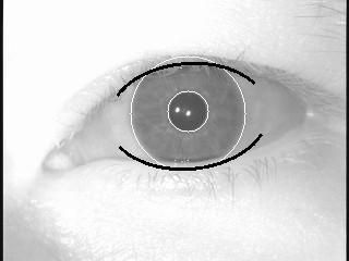 The detection of the corneal reflection is simple because they are very bright pixels compared to the dark pixels of the pupil.