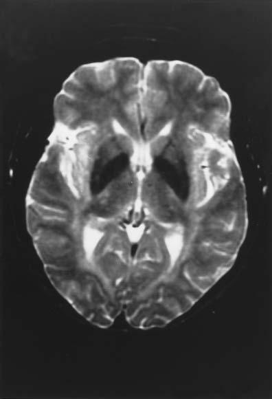 the brain, TE 20 ms, TR 2700 ms.