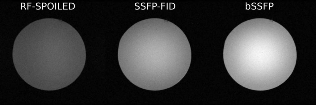 SSFP sequence has two basic variations: SSFP-FID (aka FISP, GRASS, FFE) if the net gradient area is zero before read out, SSFP-ECHO (aka PSIF, SSFP, T 2 -FFE) if the net gradient area is zero after