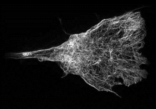 2 µm Axon Actin (Growth Cone) excite 488nm, detect > 510 nm 24 lp/mm = 88% of frequency