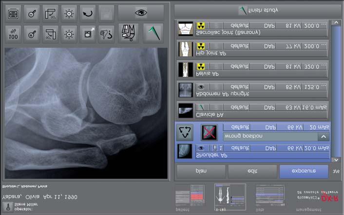 Shows an example of a correct X-ray image dicompacs DX-R radiographic positioning guide Opens examples