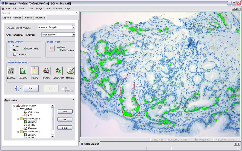 HCImage Analysis includes all functionality of HCImage Live and Acquisition, plus an extensive selection of image analysis tools.