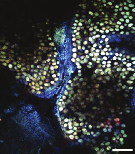 Multimodal microscopy image of an unstained, undissected Drosophila melanogaster RFP mutant larva.