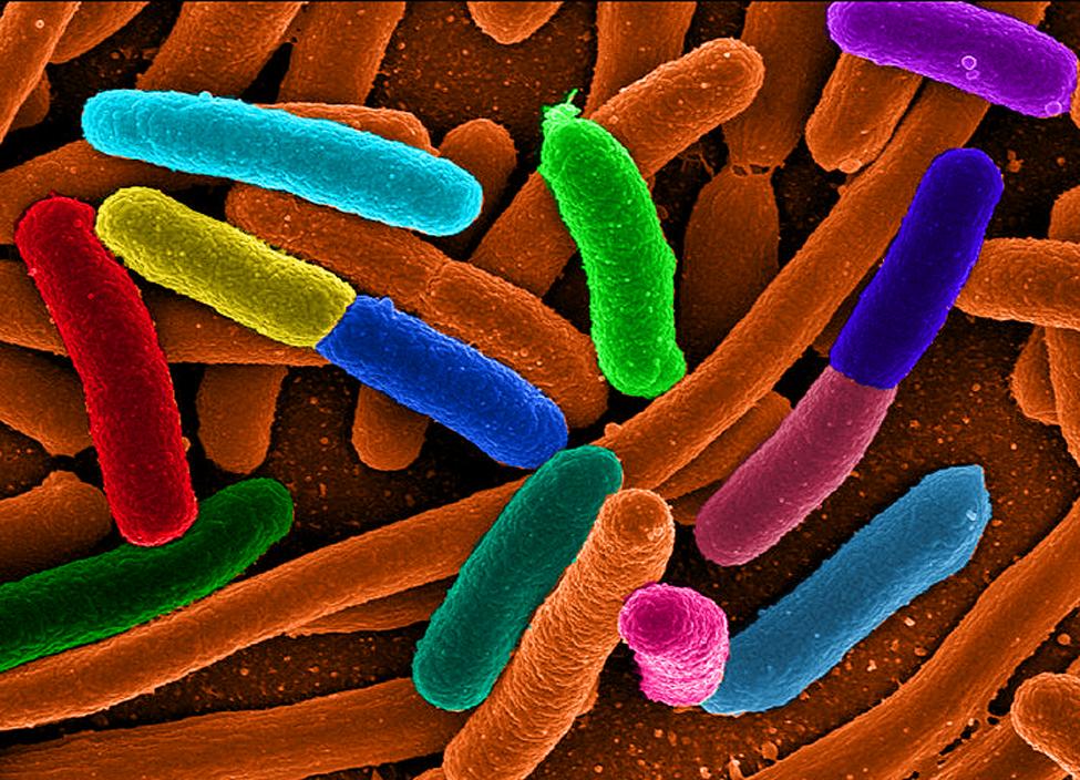 Chapter 4 Exponential and Logarithmic Functions 529 4 EXPONENTIAL AND LOGARITHMIC FUNCTIONS Figure 4.1 Electron micrograph of E.Coli bacteria (credit: Mattosaurus, Wikimedia Commons) 4.
