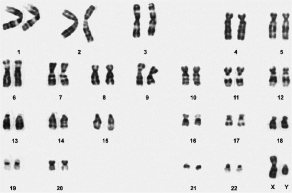 Human Chromosomes 23 pairs