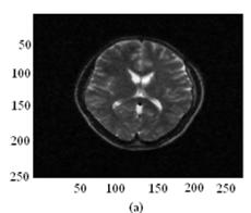 The size of image is 256 256 and 16-bit signed integer. Fig. 1 shows the noisy MRI image. Result from the experiment using the proposed noise removal method is presented in Fig. 2. Background part is excluded when our proposed noise removal method is applied in MRI image.