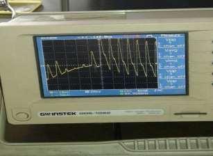 waveform Fig 10 ECG