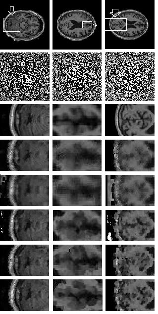 Figures 2 and 3 show, the edge boundaries and similarity of different natural and MRI images after applying the proposed filter in the presence of high intensity noise. III.