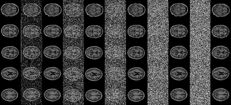 Figure 6. Results of applying the proposed filter on MRI images corrupted by different levels of impulse noise.