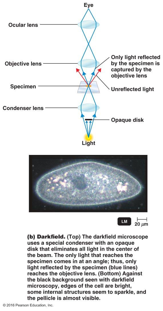 Darkfield Microscopy Specimen appears light on a dark background Handy in situations where we want to see live cells, cells are hard to see in