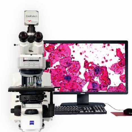 GRAM IMAGER Manual Digitization of Gram Stains Hospital and private laboratory networks often run numerous laboratories.