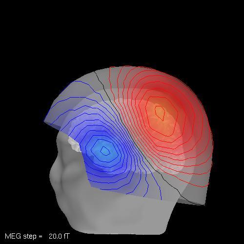 MEG EEG MEG and EEG Distributions radial tilted