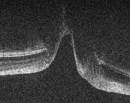 Zoomed in images (right) of the photoreceptors near their termination at the optic nerve head are extracted from